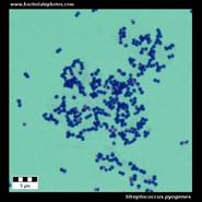 streptococcus pyogenes microscopy
